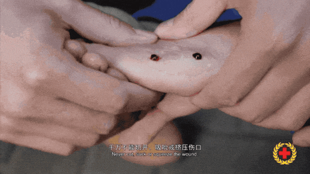 松桃一男子穿拖鞋上山種辣椒被TA咬！有劇毒！